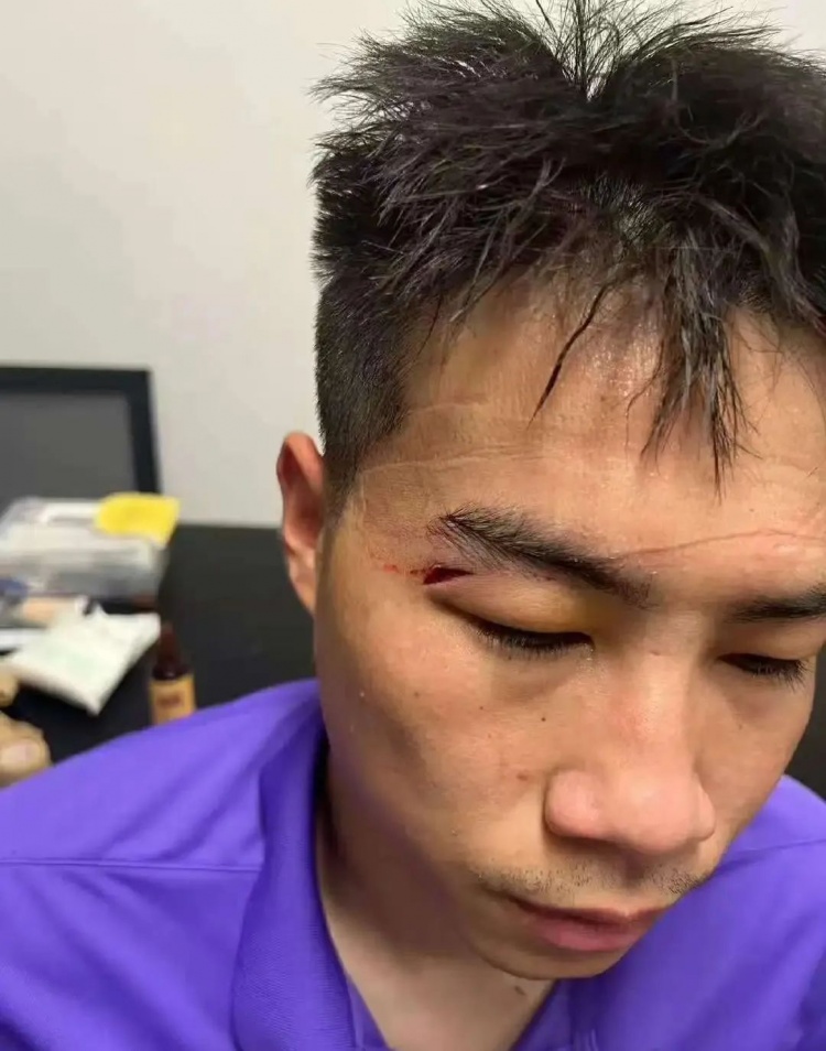 华体会体育官方是国米赞助商-津媒：王献钧两颗门牙被撞断，杨帆眉骨受伤赛后去医院缝针